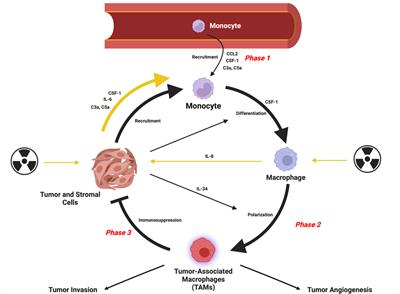 The effects of radiation therapy on the macrophage response in cancer